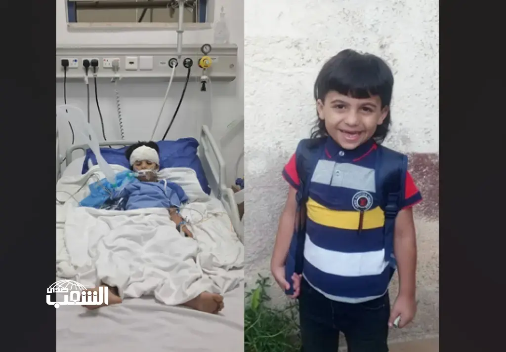 أربعيني يعتدي على طفلين .. وإصابة أحدهما بـ"تفتت في الجمجمة ونزيف في الدماغ"